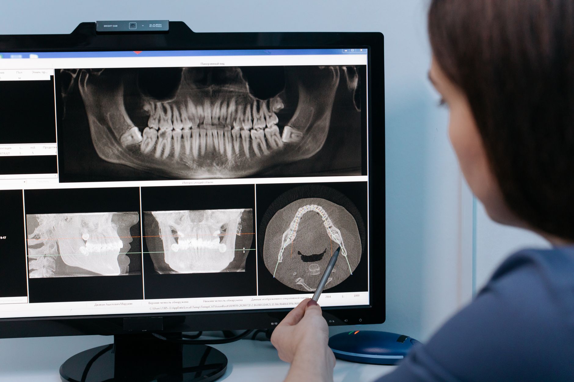 dentist pointing at a dental radiograph on a monitor with a patient chart nearby